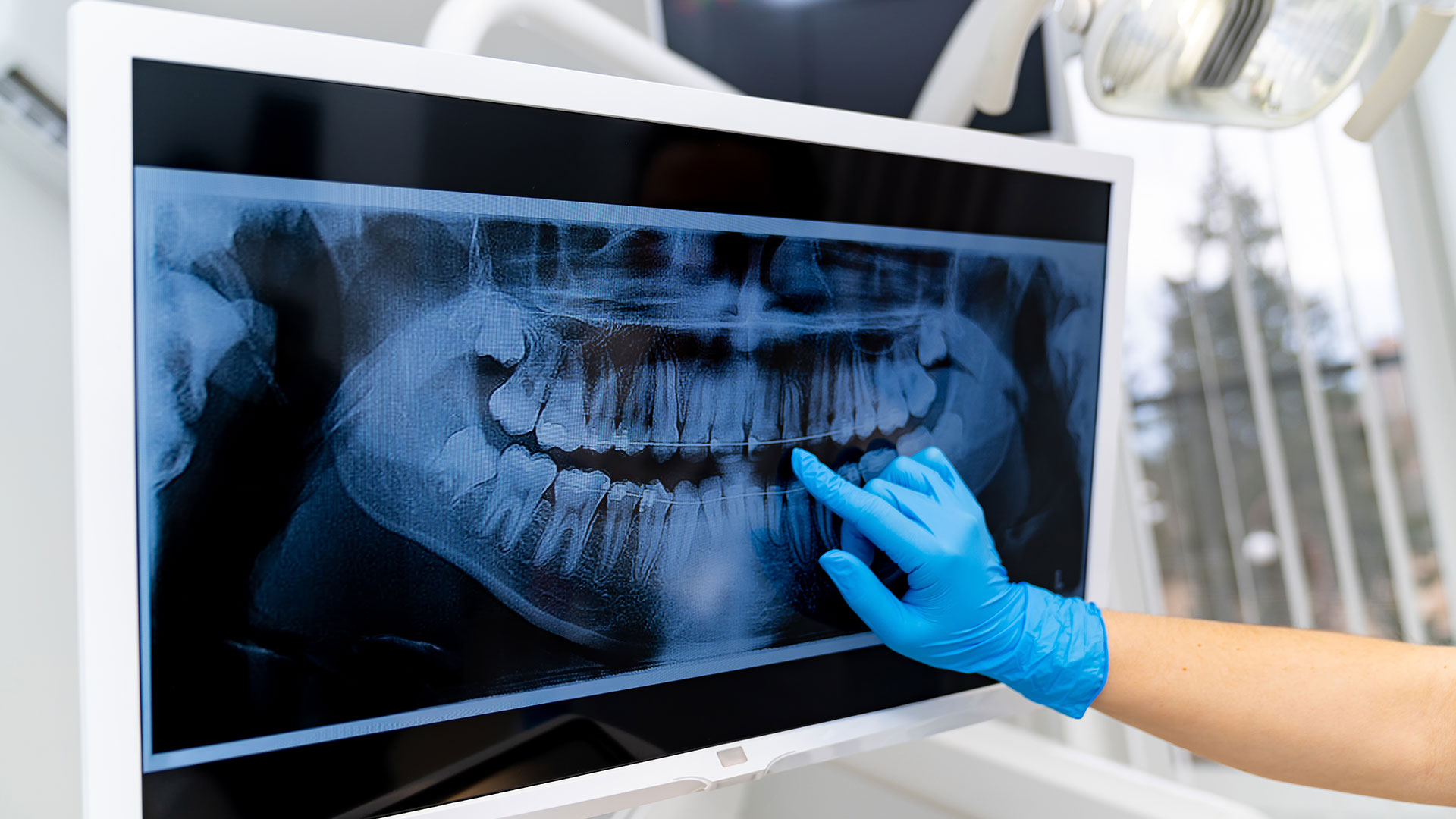 Dental Radiographs in Bonita Springs Dental professional reviewing a panoramic dental X-ray in Bonita Springs