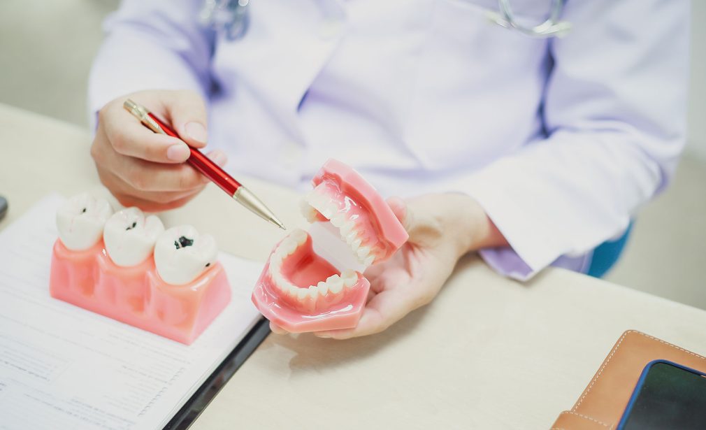 Dentures in Bonita Springs Florida 34134