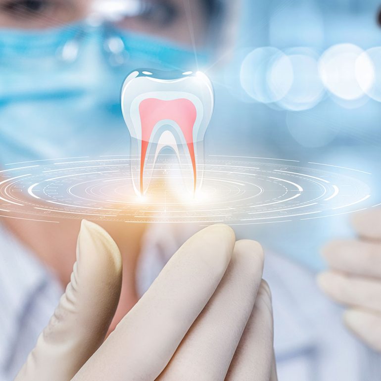 Pain-free root canal at Dental Blush Bonita Springs