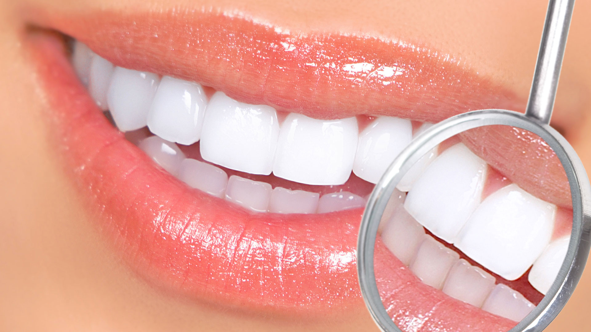 Teeth Whitening in Bonita Springs Close-up of a bright smile during a teeth whitening consultation in Bonita Springs