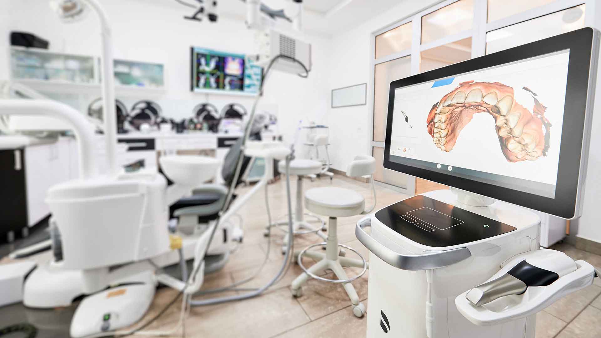 Digital Dental Scanning Technology in Bonita Springs Digital dental scanner displaying a three-dimensional image of teeth in a modern dental treatment room