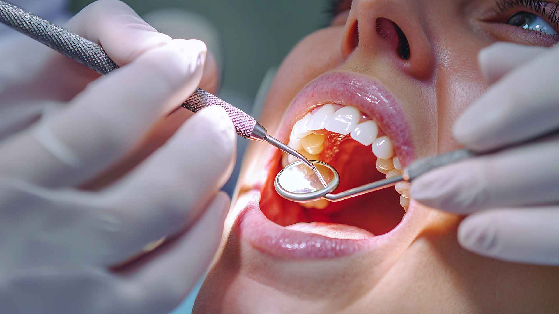 Urgent Dental Evaluation at Dental Blush Bonita Springs Dental professional examining a patient during an urgent dental evaluation in Bonita Springs