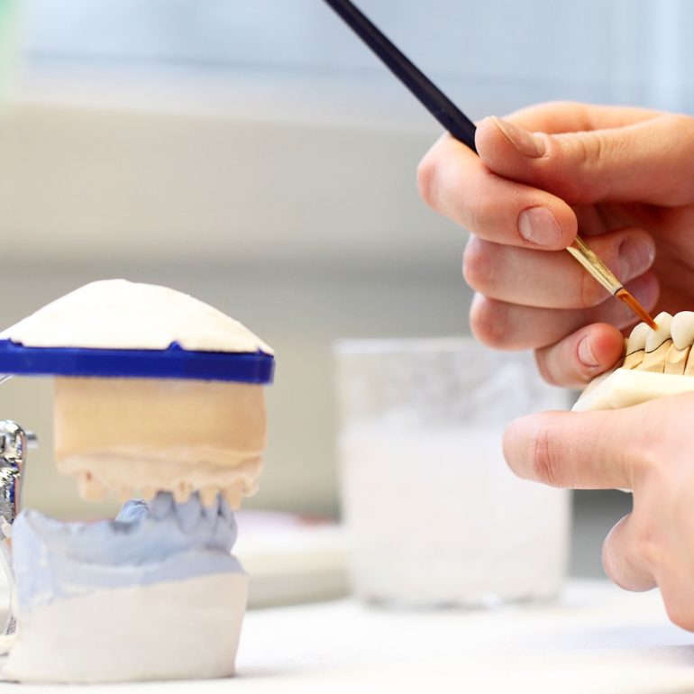 Partial Dentures at Dental Blush Cape Coral