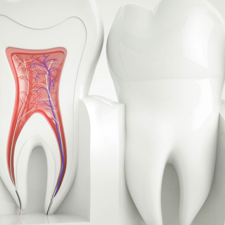 Restored tooth after root canal – Dental Blush Cape Coral