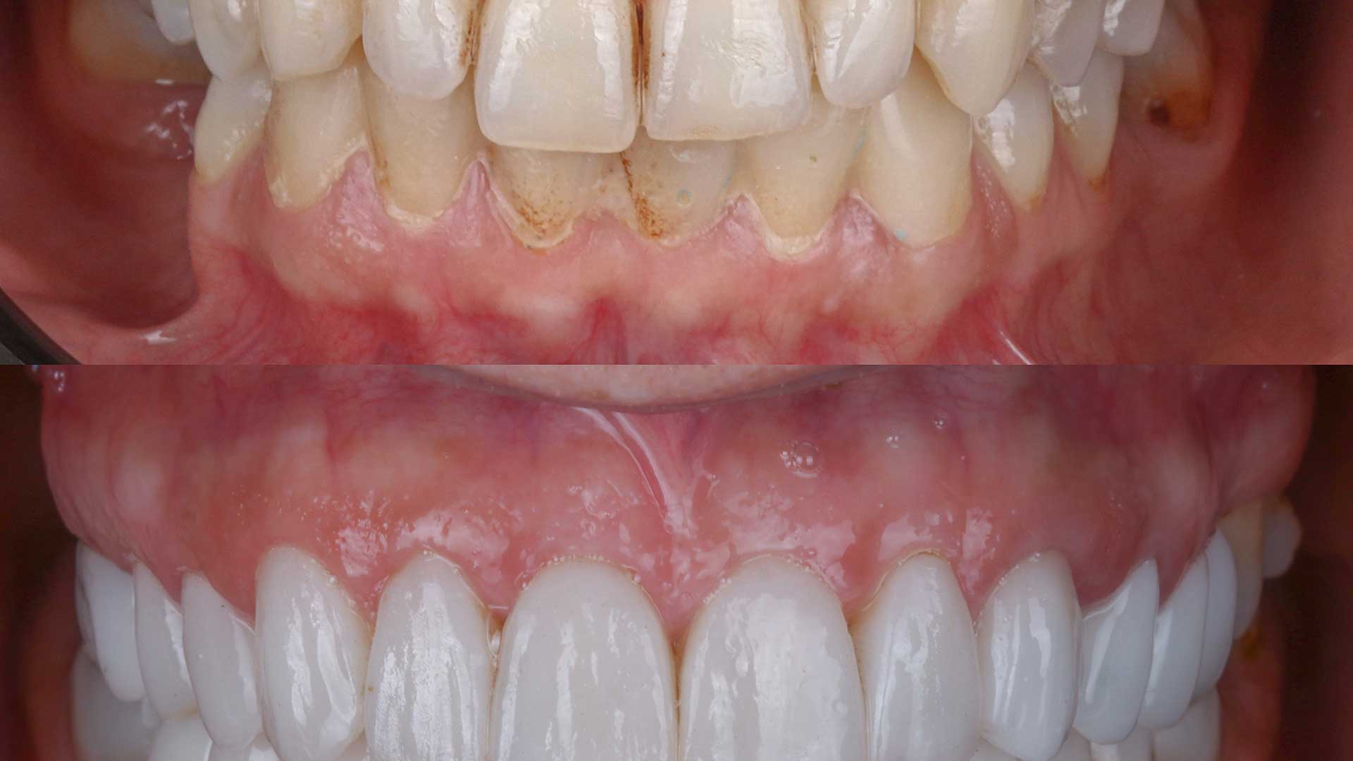 Smile Makeover Cape Coral Cosmetic smile makeover planning in Cape Coral