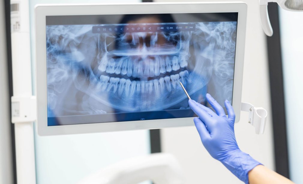 Panoramic dental X-ray in Lauderhill FL