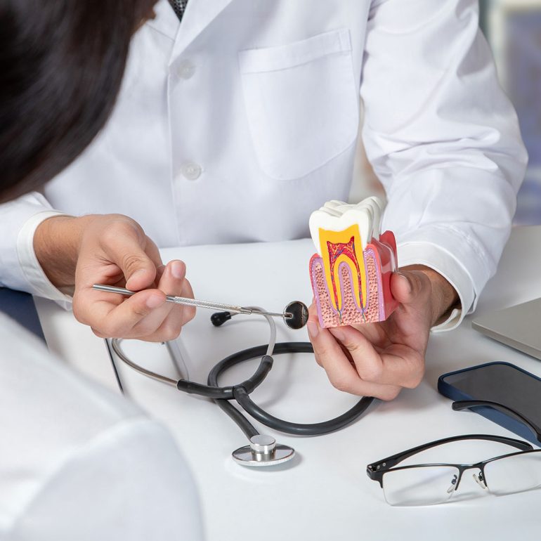 Dental Blush Sunrise FL Root Canal Procedure