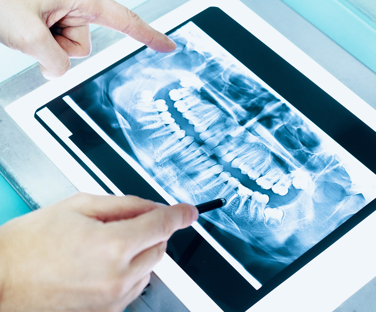 Dental Blush aboutdentist Radiographs  