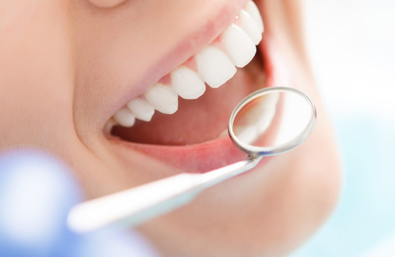 Dental Blush accept_insurance-770x500 Services  