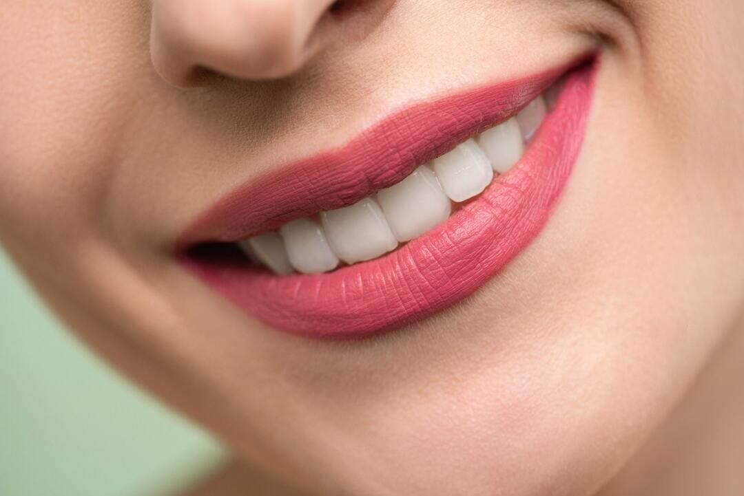 Dental Blush smile-design Smile Design  