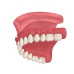 Dental Blush dentures-150x150 The Benefits of Dentures: How They Can Improve Your Smile and Quality of Life Dental  Dentures near me Dentures Miami Dentures Benefits of Dentures 