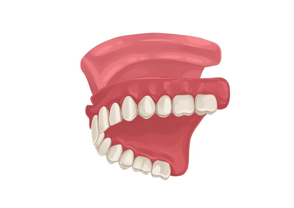 Dental Blush dentures The Benefits of Dentures: How They Can Improve Your Smile and Quality of Life Dental  