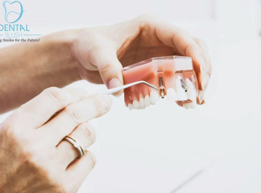 Healthy-Teeth-Oral-Hygiene-Tamiami