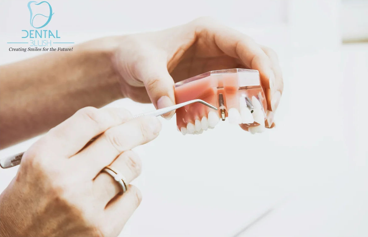 Healthy-Teeth-Oral-Hygiene-Tamiami