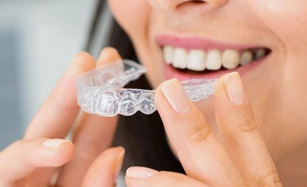 Clear Invisalign aligners in Miami FL