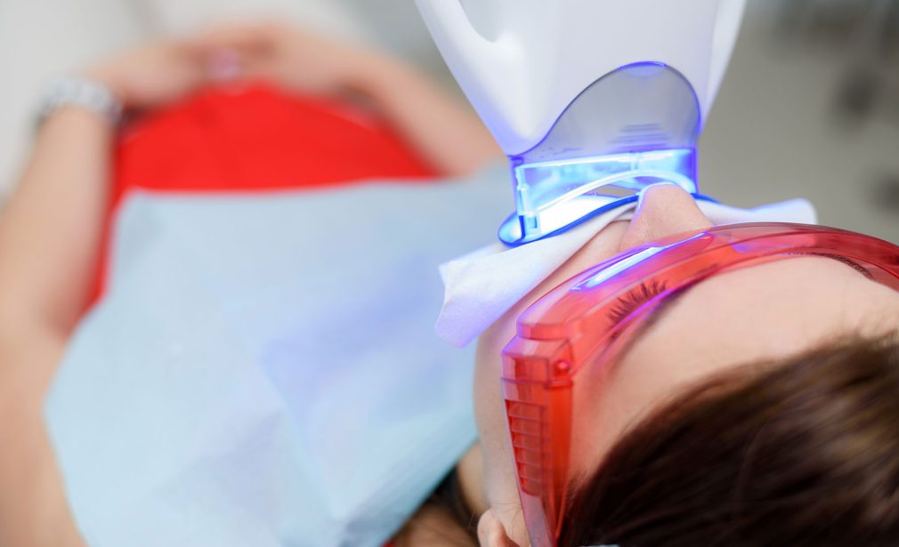 Teeth Whitening in Tamiami – professional dental whitening at Dental Blush Miami FL