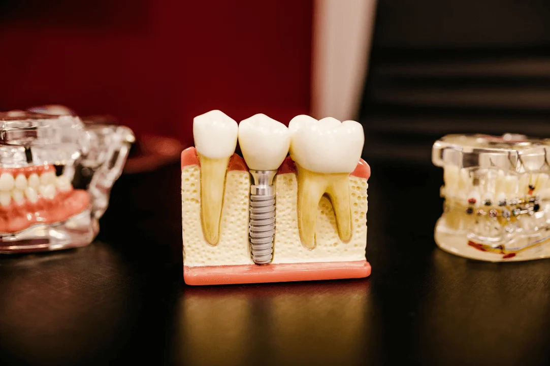 Dentist with patient, Dental Blush Tamiami, FL
