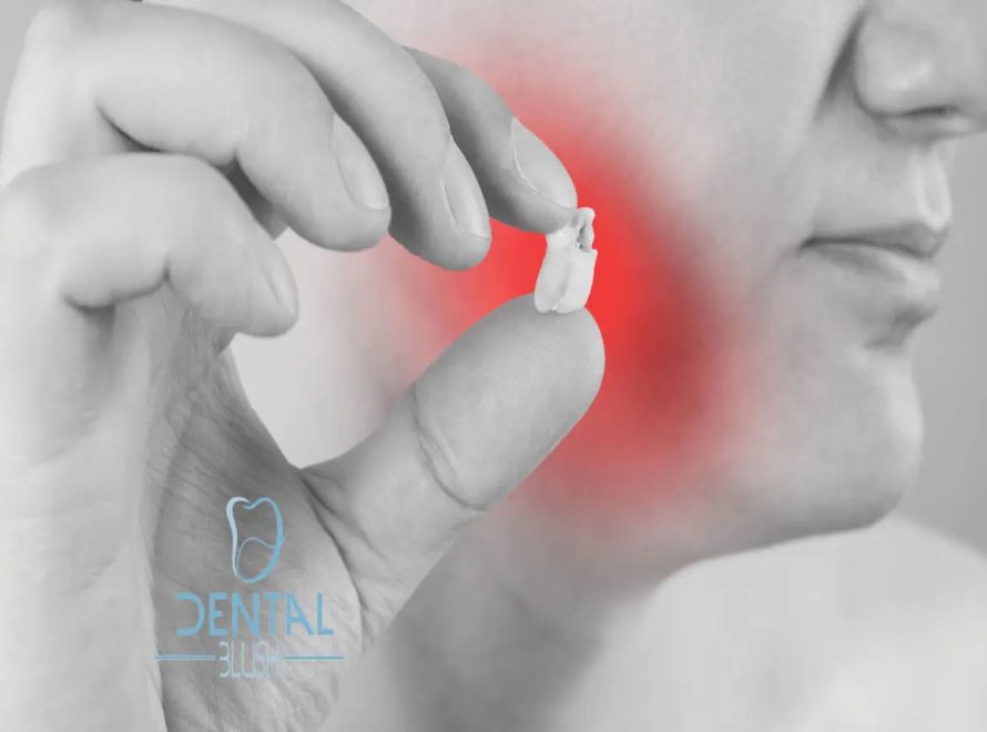 Dental-Surgery-Wisdom-Teeth-Miami