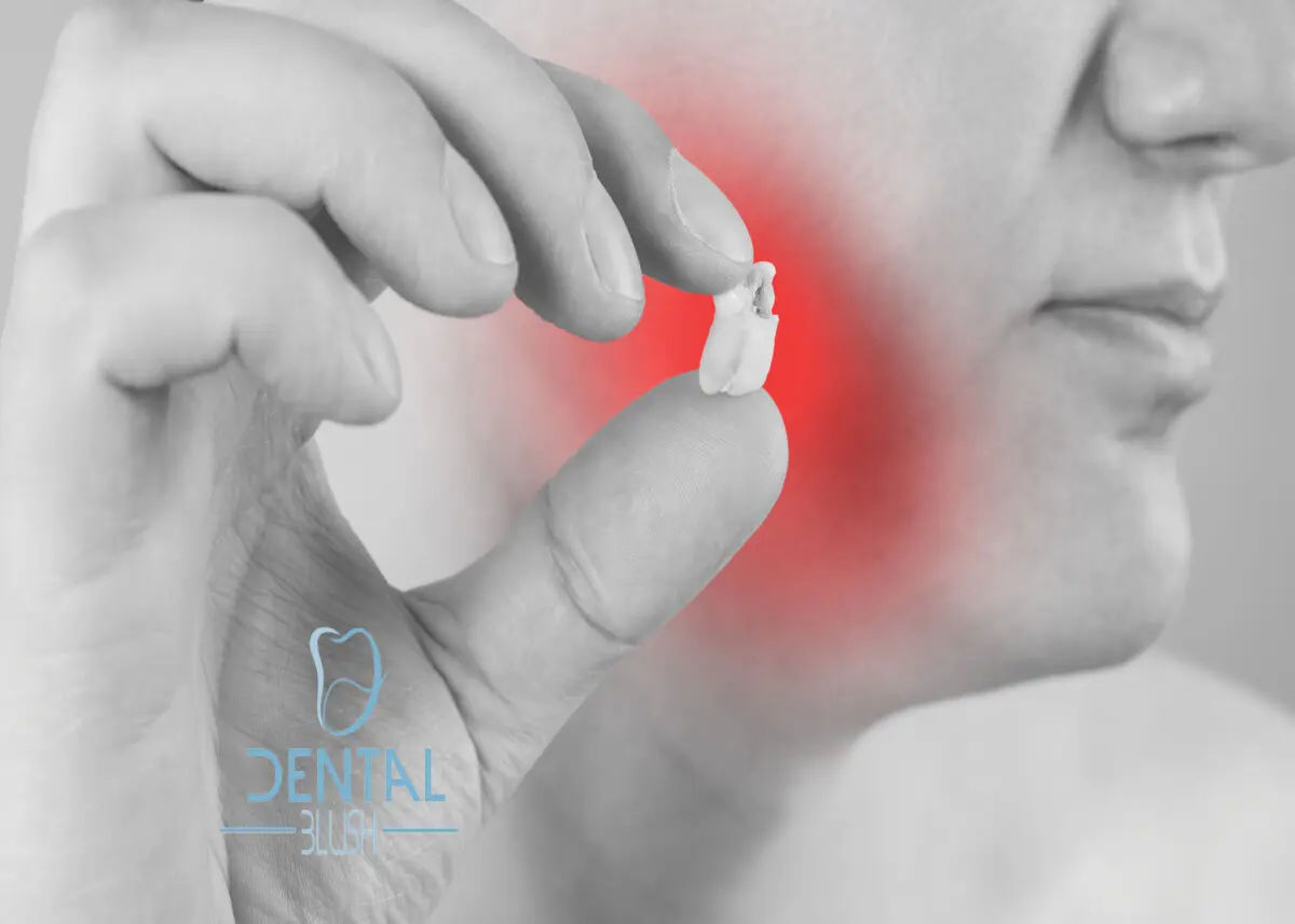 Dental-Surgery-Wisdom-Teeth-Miami