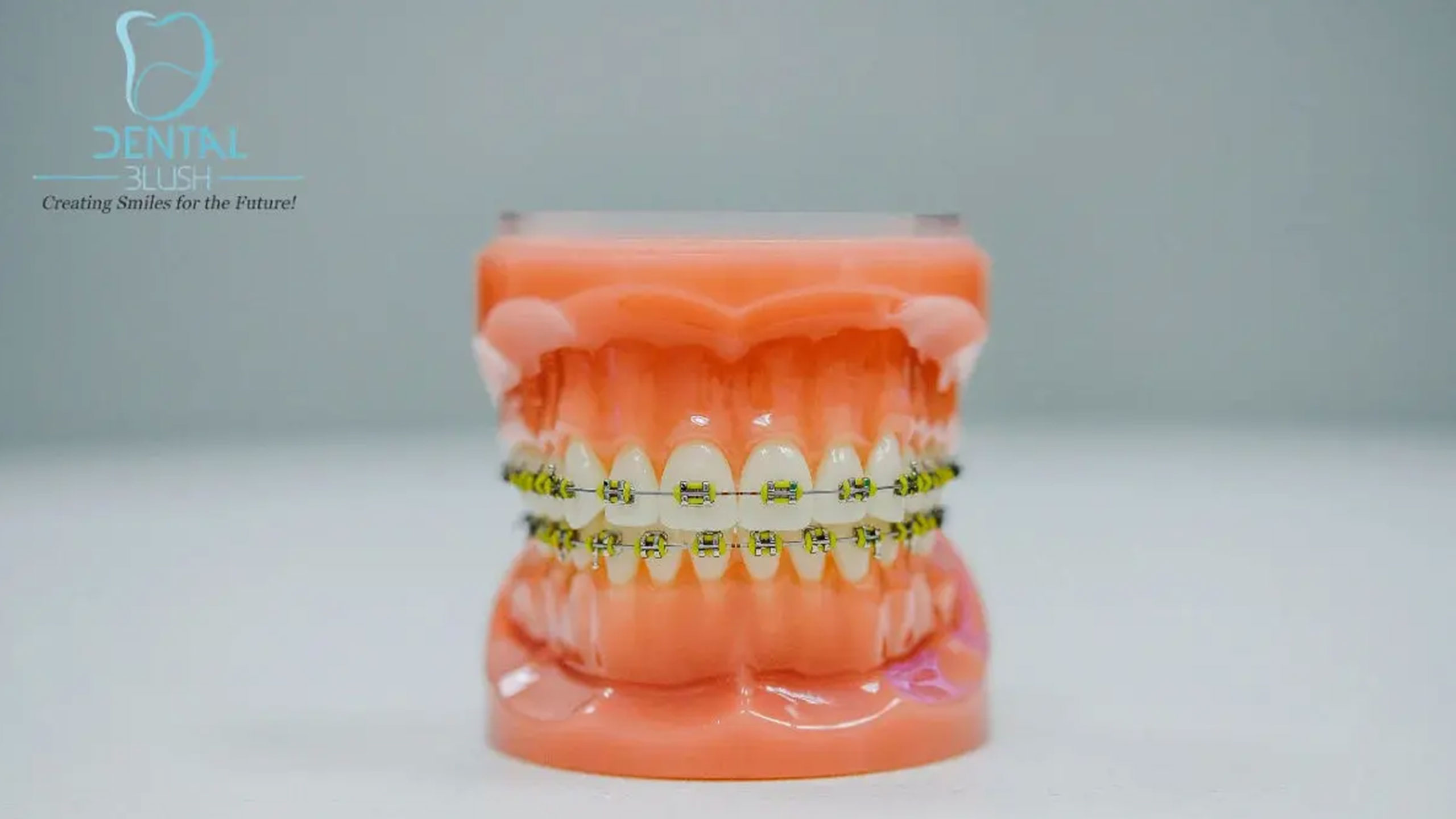 Foods During Orthodontic Treatment – Dental Blush