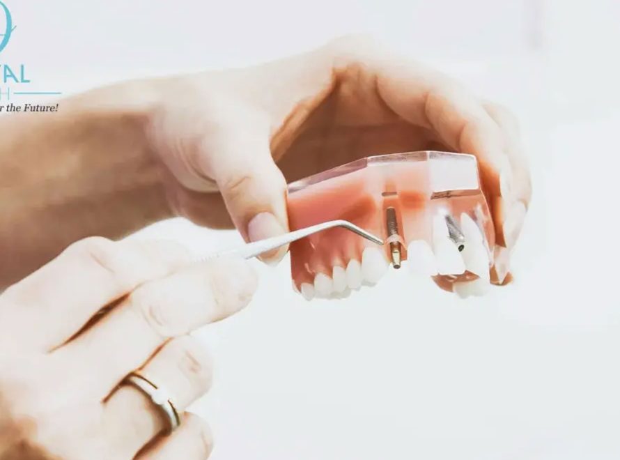 Oral Hygiene in Miami – preventive dental care at Dental Blush
