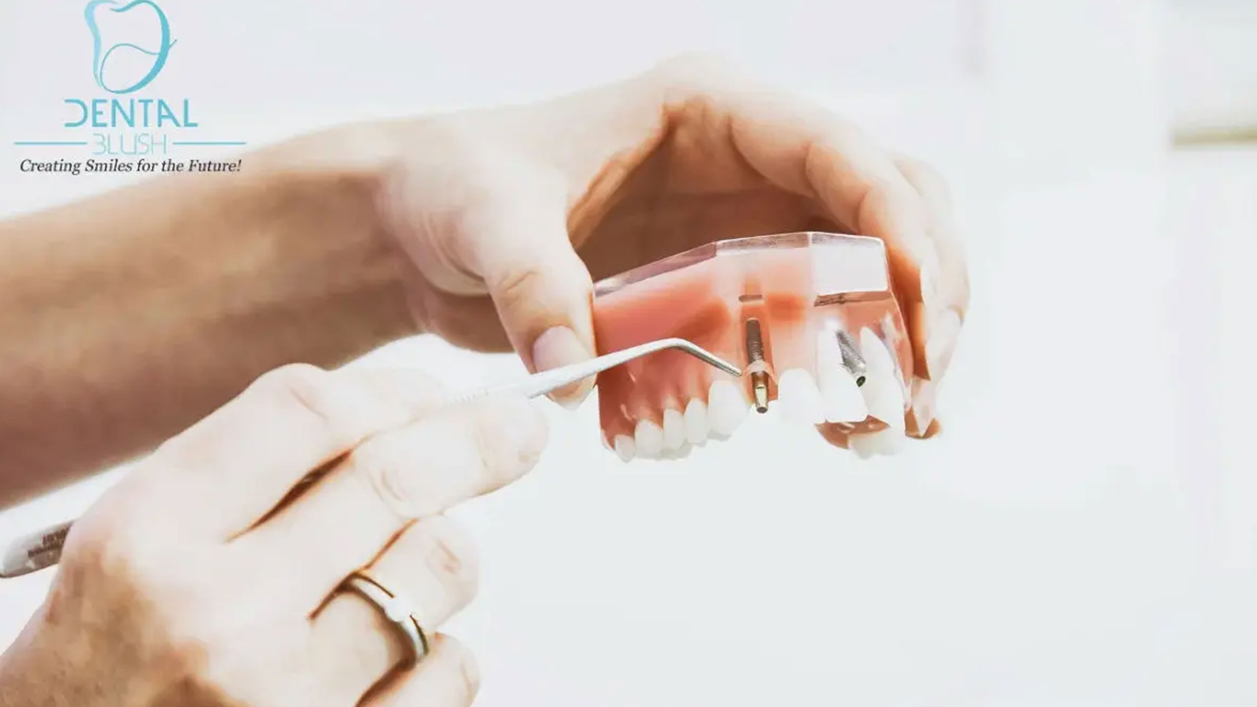 Oral Hygiene in Miami – preventive dental care at Dental Blush