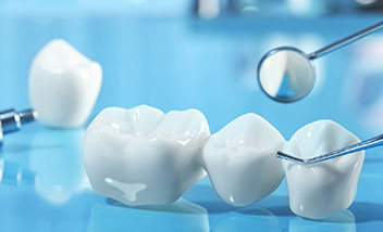 Dental Crowns in Tamiami Fontainebleau, Miami, FL | Dental Blush Dental crowns at Dental Blush Tamiami Fontainebleau, Miami, FL