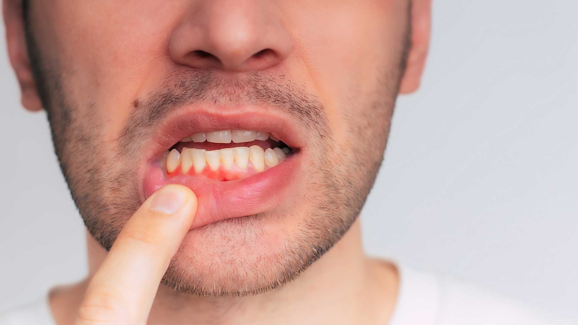 Dental Periodontics in Miami at Dental Blush Tamiami Dental periodontics in Miami with dental team treating a patient at Dental Blush Tamiami