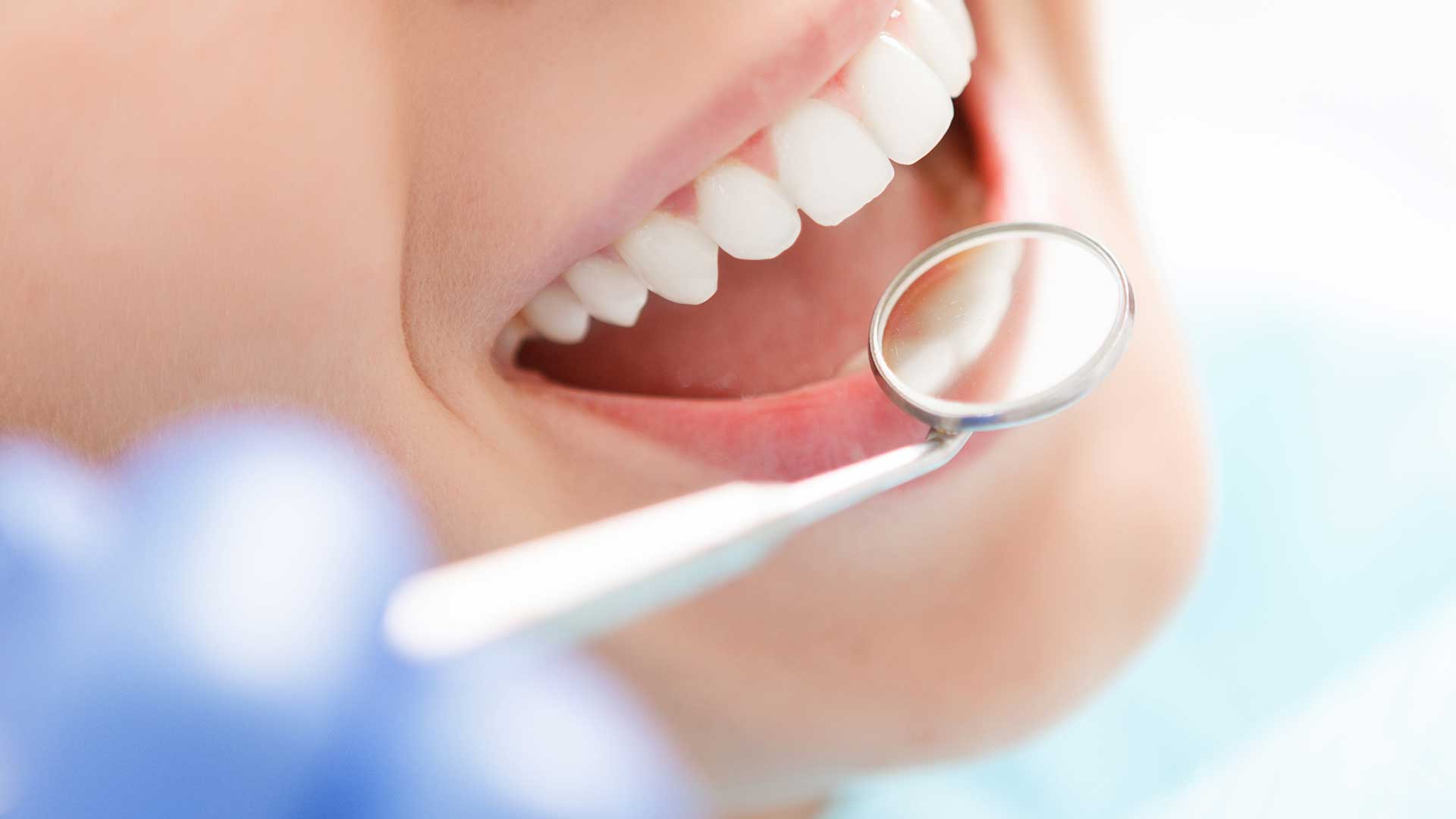 Teeth Cleaning in Miami at Dental Blush Tamiami Teeth cleaning in Miami with dental hygienist treating a patient at Dental Blush Tamiami